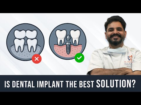 Immediate Load Implants